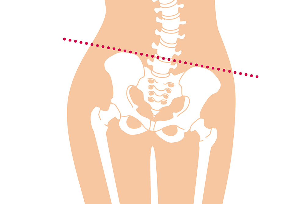 硬い骨盤・左右非対称